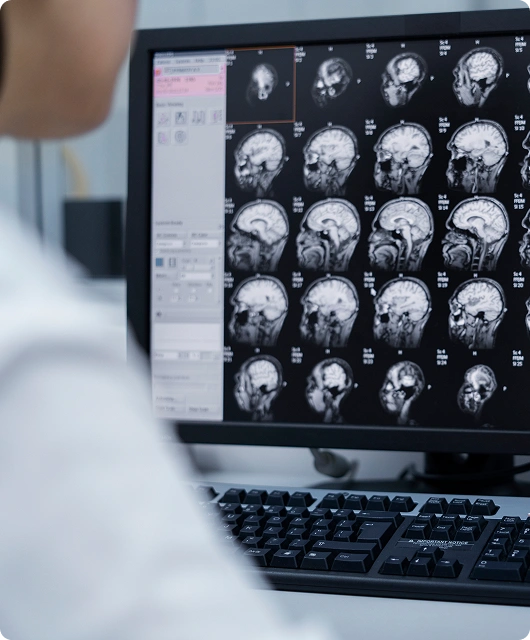 imaging technology brain scans and mri