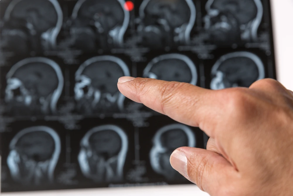 brain imaging